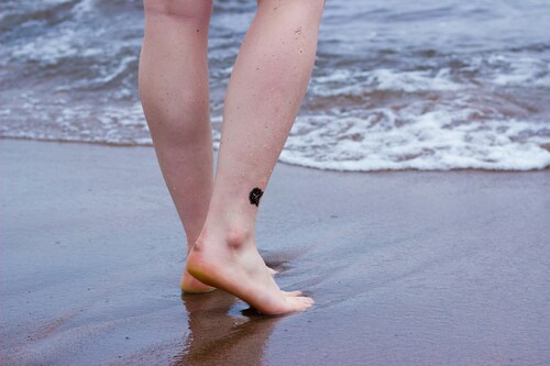 How Does a Vein Specialist Diagnose and Treat Leg Swelling